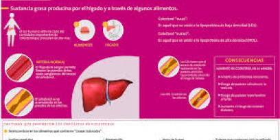 Infografía sobre el colesterol, causantes y consecuencias.