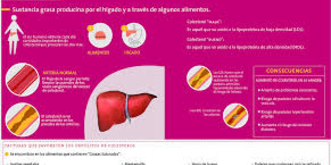 Infografía sobre el colesterol, causantes y consecuencias.
