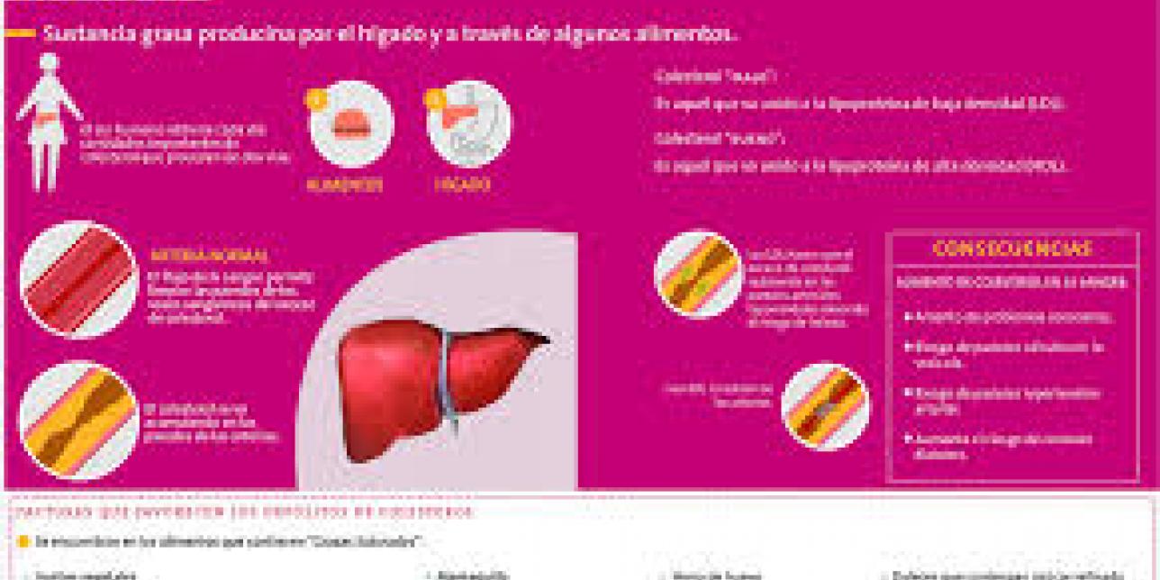 Infografía sobre el colesterol, causantes y consecuencias.