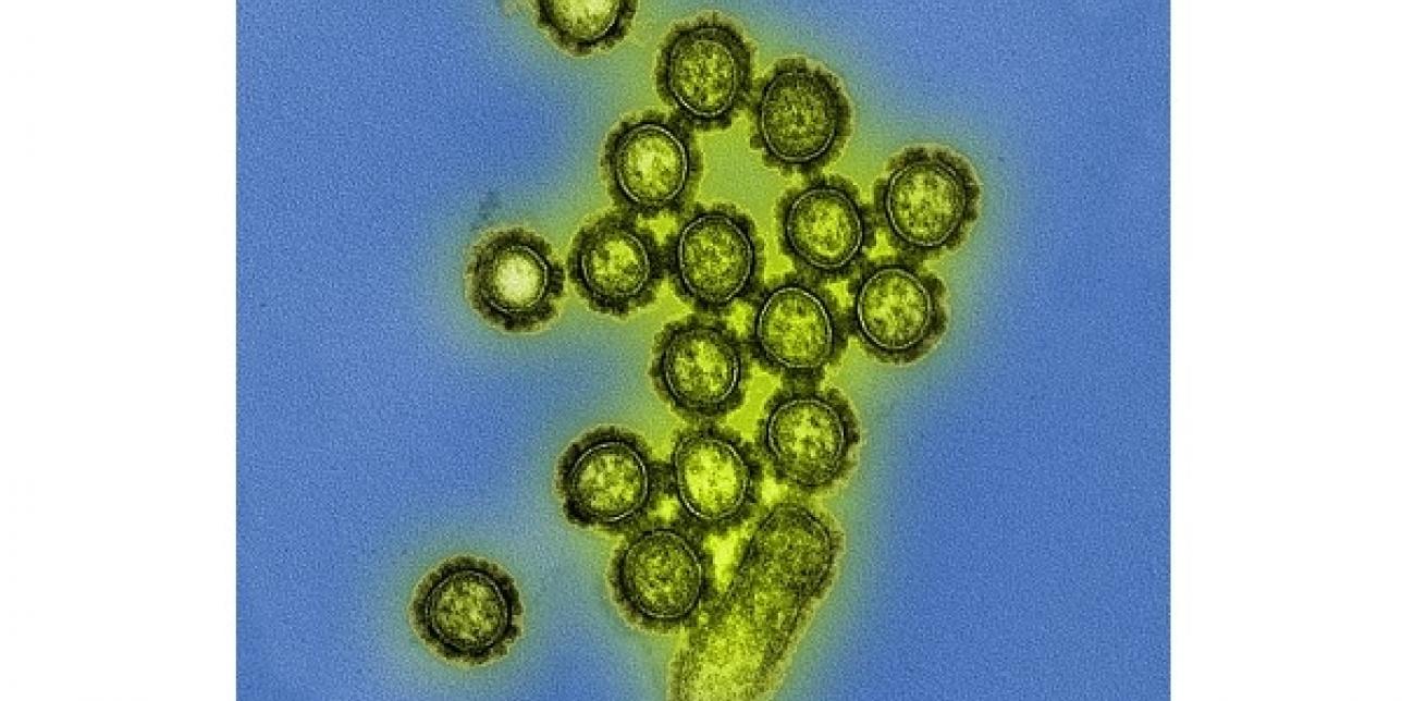 Microfotografía que muestra las partículas del virus H1N1 Influenza
