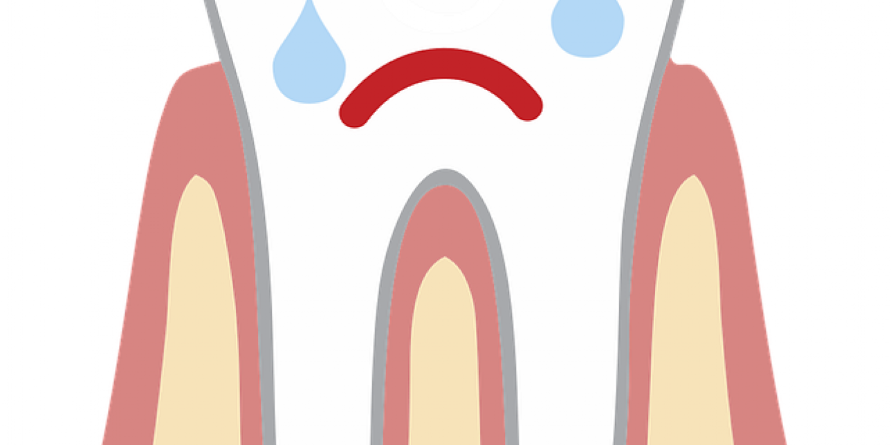 Ilustración de un molar con cara llorando. Imagen de dominio público. 